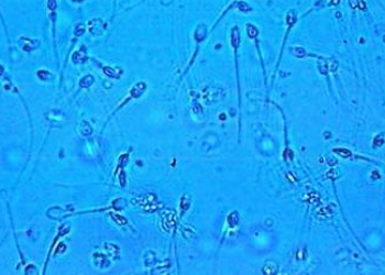 “弱精症”，泰国试管婴儿一招搞定！