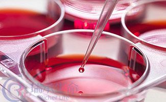 试管婴儿胚胎实验室流程你知道吗？