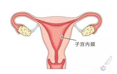 子宫内膜
