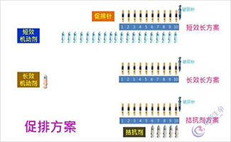 试管婴儿促排长方案费用贵不贵？