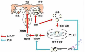 试管婴儿流程-体外授精