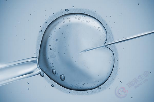 卵胞浆内单精子注射.png