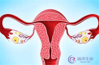 女性做试管会导致卵巢早衰？做一次试管婴儿老十岁？  