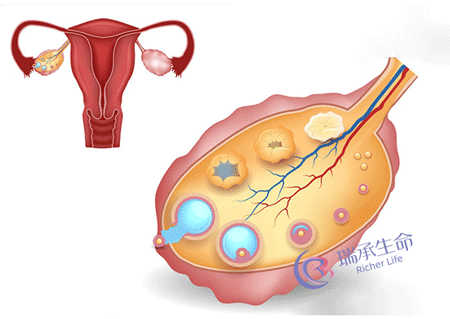 瑞承生命：卵泡.png
