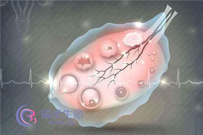 卵泡为何不成熟？泰国试管婴儿如何提高促排/取卵效果？