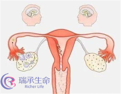 因输卵管问题引起的不孕症，去泰国做试管婴儿可行吗?