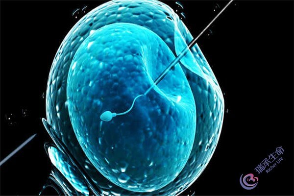 泰国试管婴儿技术：单精子注射与染色体异常检测
