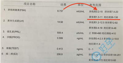 性激素六项第 1 项升高对卵巢有影响吗？