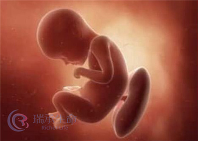 泰国第三代试管婴儿成功后，胎儿还会有缺陷吗？