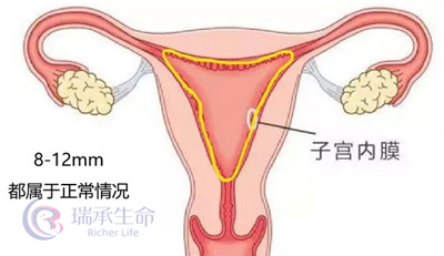 什么样的内膜和卵泡才能促进试管好孕？