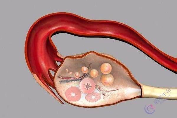 排卵障碍?第三代试管婴儿如何实现生育健康宝宝？