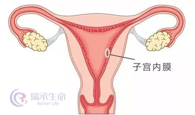 试管婴儿失败原因，看了你就知道了