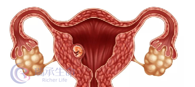 子宫内膜薄，怀孕能力也会大大降低！这是为什么？