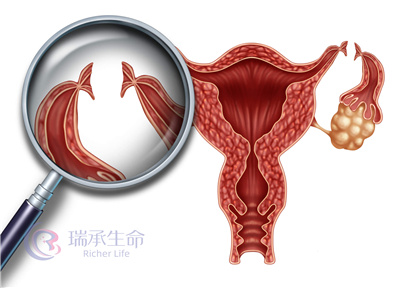 久备不孕是输卵管的问题？关于输卵管检查，要知道这些