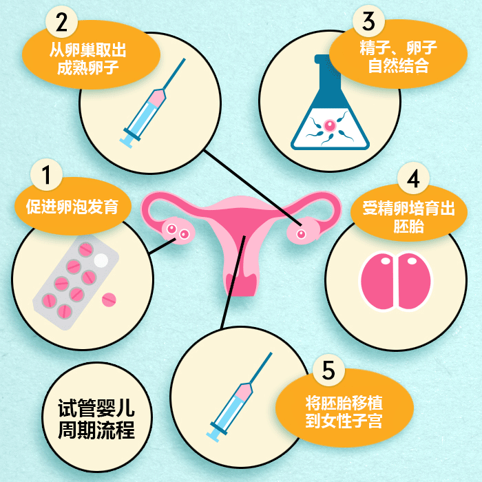 做试管婴儿的全过程是怎样的？