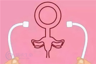 输卵管导致不孕的主要分这两种情况