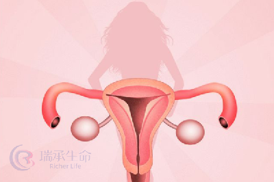 卵巢发育不全如何做试管婴儿?有哪些注意事项?
