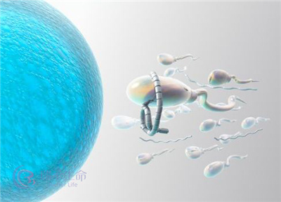 试管婴儿如何解抗精子抗体导致的不孕