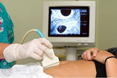 试管婴儿助孕B超检查起到什么作用呢