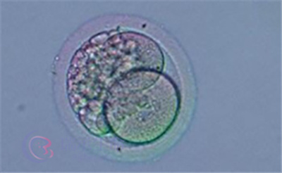 胚胎碎片率高做试管能不能生育健康宝宝?