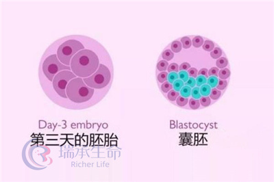 做试管婴儿为什么说囊胚比早期胚胎要好？