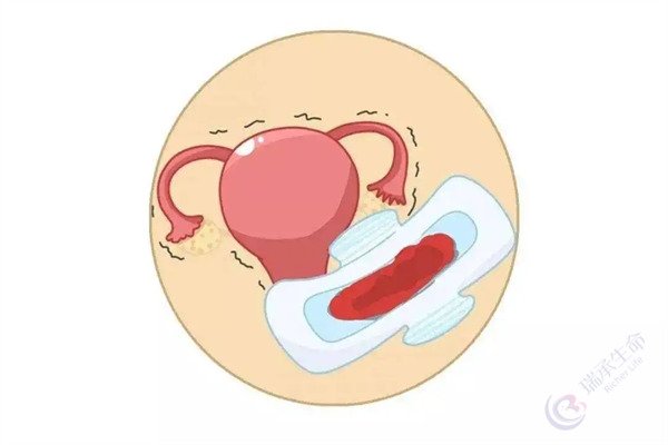 功能性子宫出血做试管婴儿，可以自己怀吗？