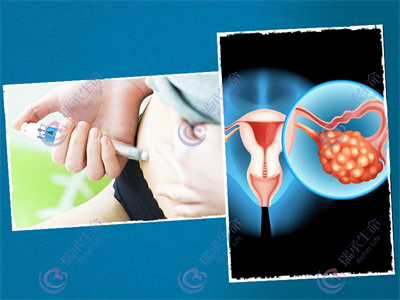 泰国试管婴儿促排卵会不会影响女性内分泌？