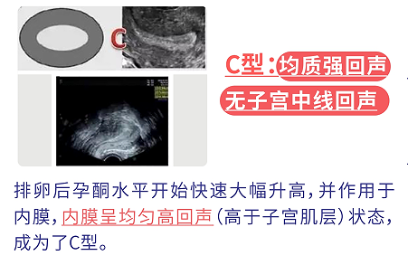 子宫内膜C型对泰国试管婴儿成功率有没有影响？