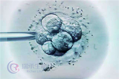 胚胎碎片率高对生育的影响，做试管可以规避吗