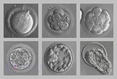 胚胎碎片率高对生育的影响，做试管可以规避吗