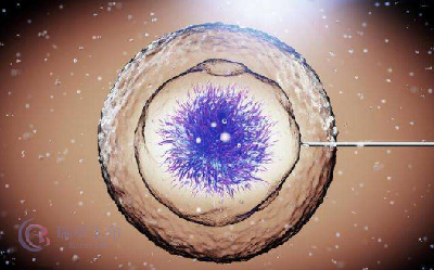 做试管婴儿如何提高卵子质量、科学促排卵？