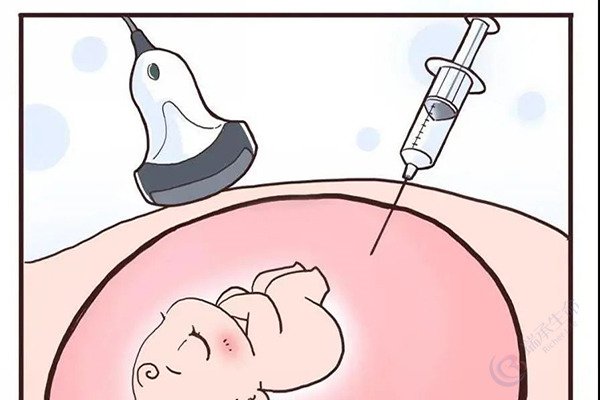 做第三代试管婴儿，孕期做羊膜穿刺的意义大吗