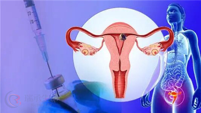 胚胎质量是影响泰国试管婴儿成功率的重要因素