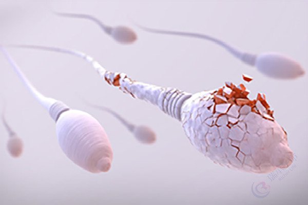 试管婴儿技术如何解决男性精子碎片率高的问题