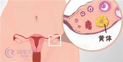 多囊卵巢做试管婴儿在饮食方面需注意什么？