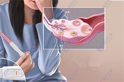 基础卵泡数量少，该如何提高试管周期效率？