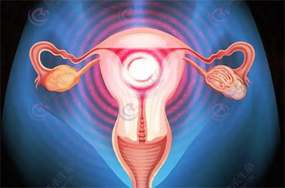 引起宫腔粘连的原因是什么？对做试管有影响吗？