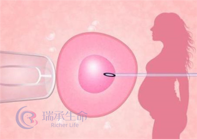 巧克力囊肿耽误好孕，泰国试管科学助孕