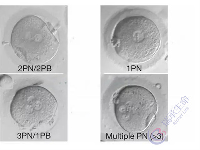 试管取卵数量多也别盲目乐观，应该做好这些事