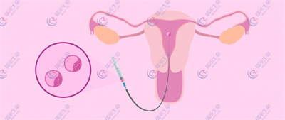 输卵管积水产生的原因是什么，影响试管囊胚着床吗？