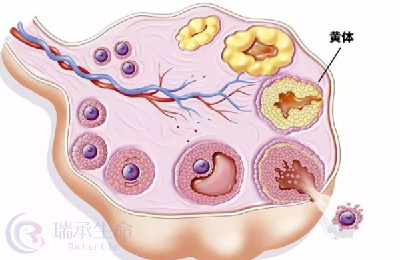 检查出黄体功能不全，对做试管婴儿有影响吗？