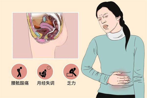 盆腔痛就一定是盆腔炎吗？做试管婴儿有影响吗？