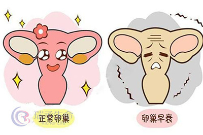 做试管期间与促排卵相关的四个常见疑问