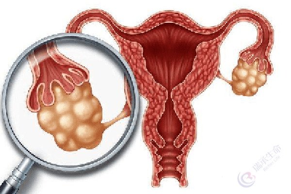 卵泡发育不良如何通过第三代试管婴儿助孕成功