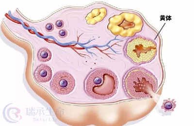 卵巢过度刺激综合症是什么原因导致的？如何降低卵巢过度刺激综合的发生？