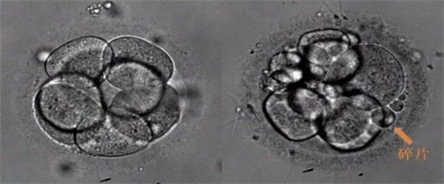 评分较低的胚胎是该继续移植还是攒胚胎？