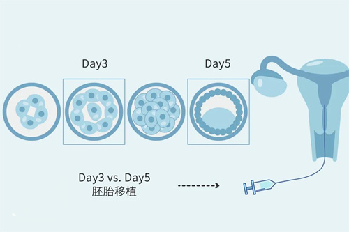 试管婴儿科普：囊胚级别和PGS通过率有关系吗？