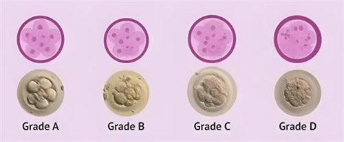 试管婴儿科普：囊胚级别和PGS通过率有关系吗？