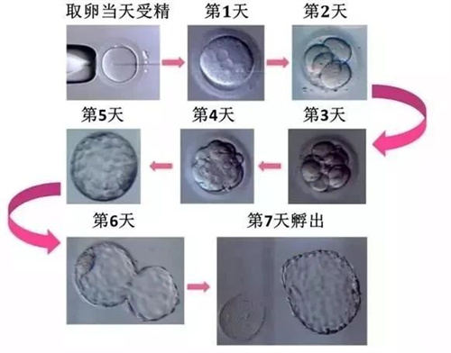 放手一搏or不想错失，试管养囊该如何抉择？