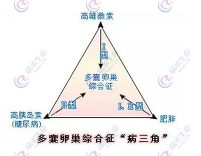 揭秘多囊卵巢综合征：了解它对试管婴儿旅程的影响